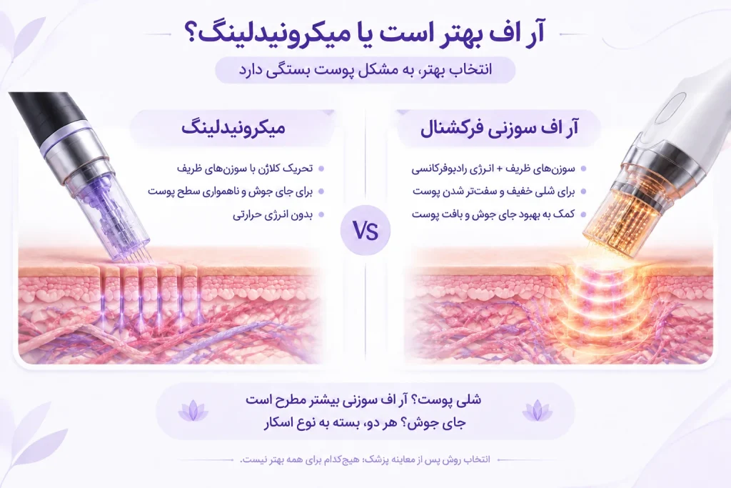 ار اف بهتره یا میکرونیدلینگ