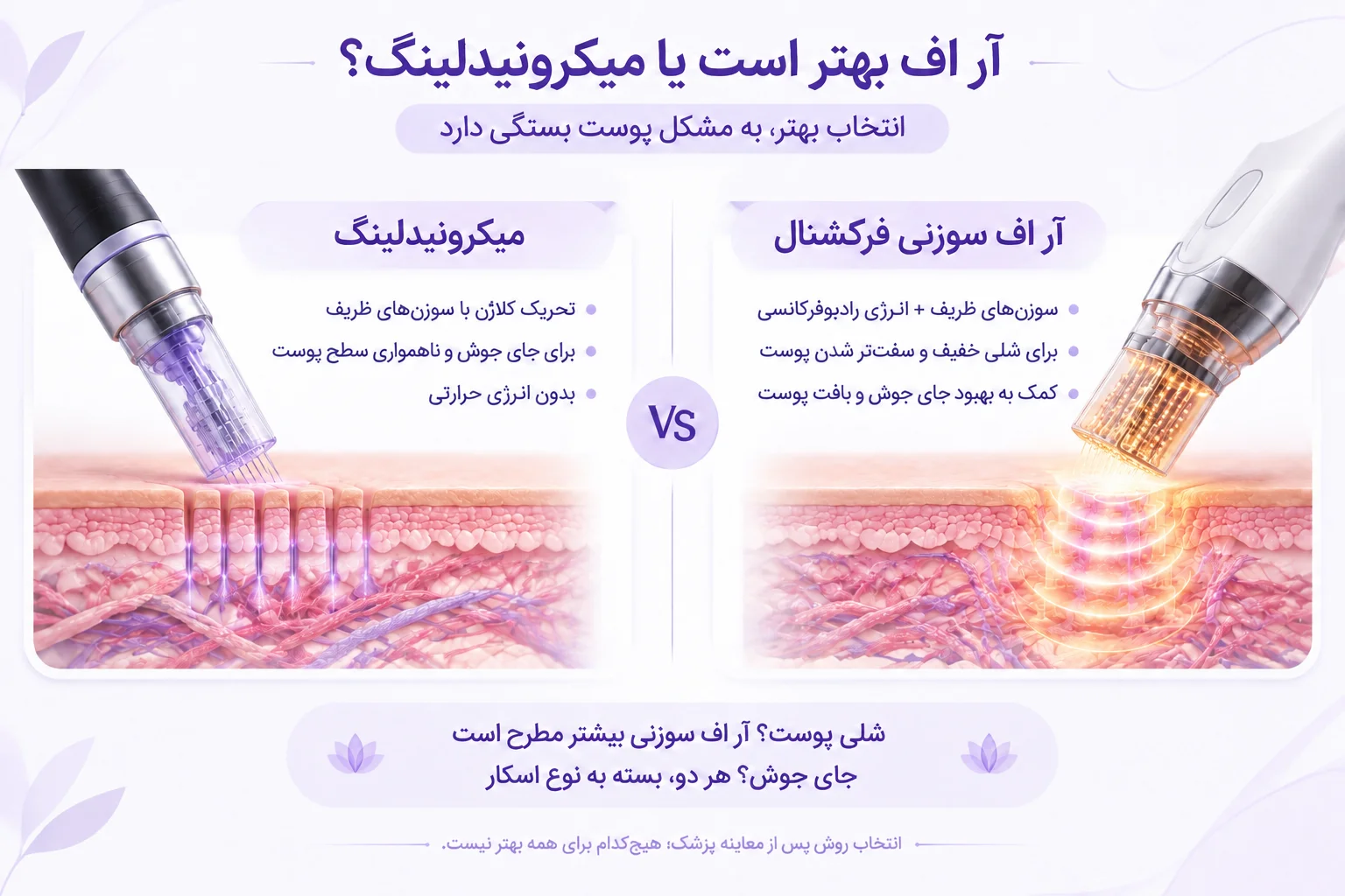 ار اف بهتره یا میکرونیدلینگ
